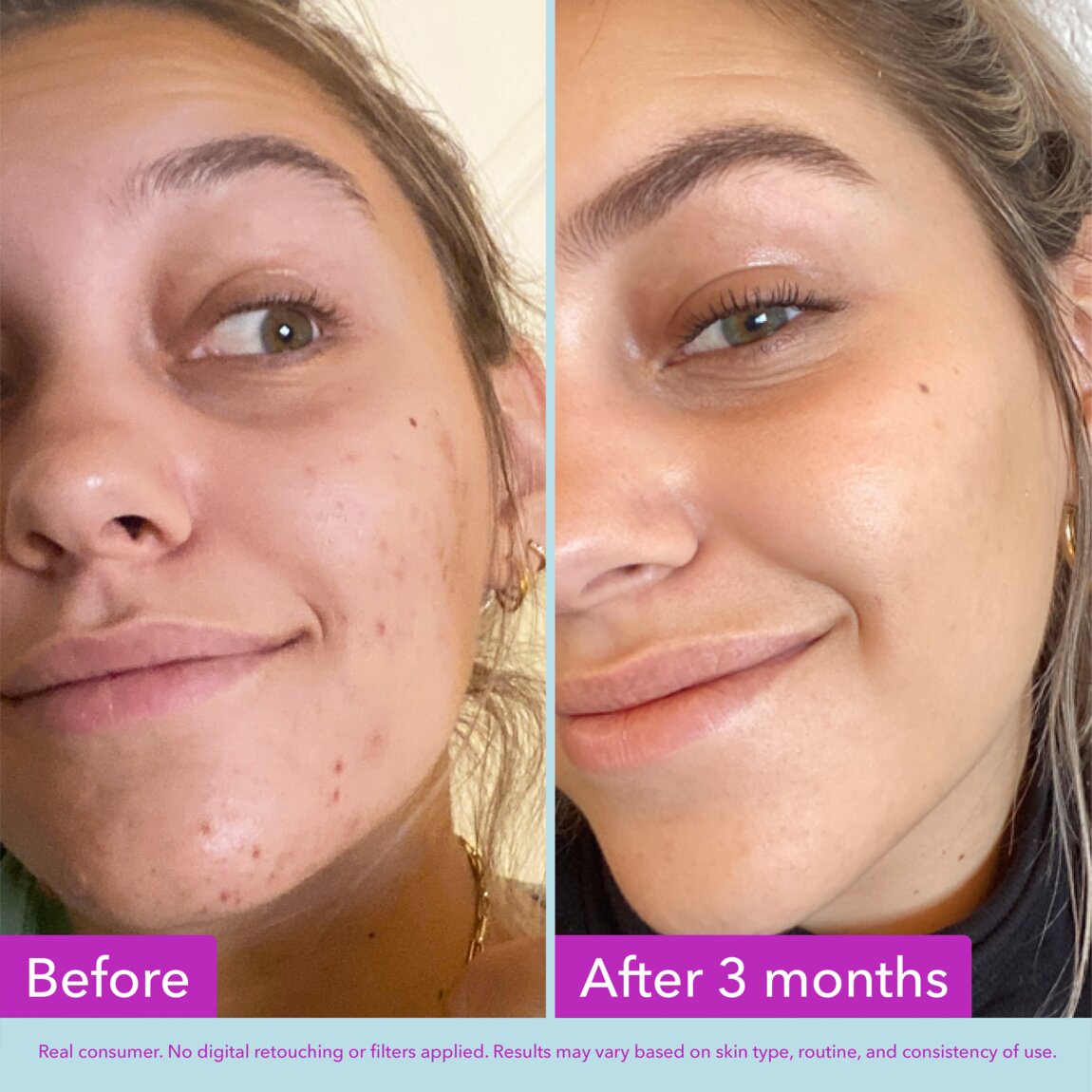 niacinamide-brightening-toner-s3 zb_p.jpg
