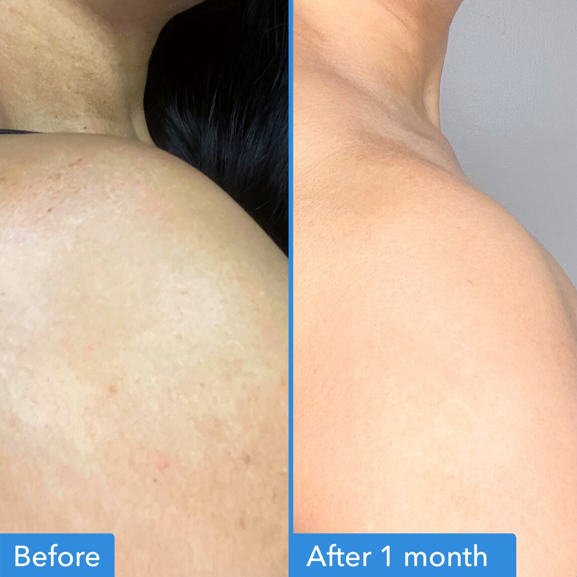 discoloration-correcting-body-treatment-q4 zb_p.jpg