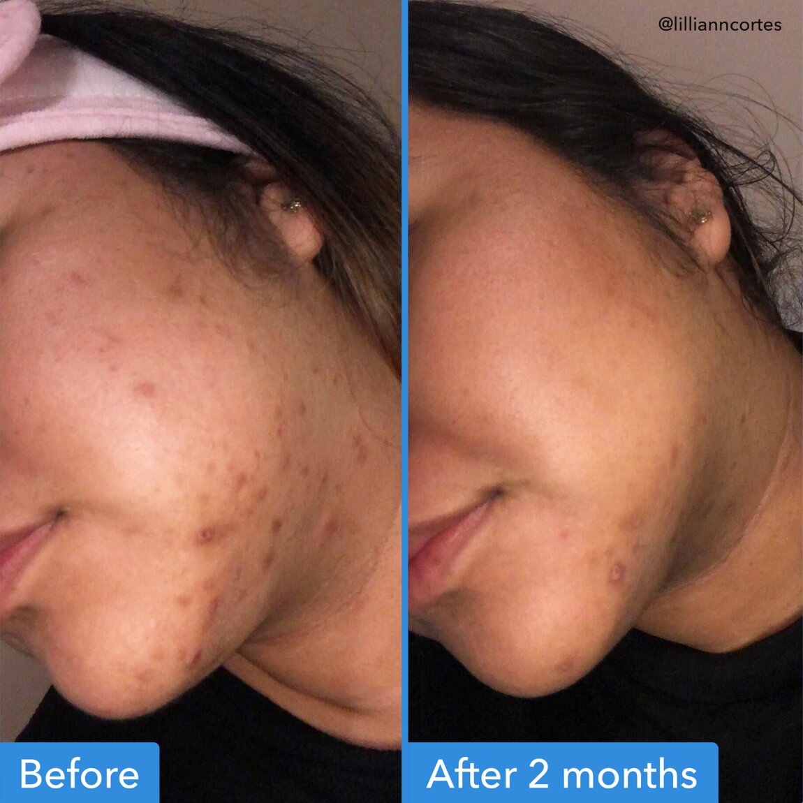 discoloration-correcting-serum-s0 zb_p.jpg
